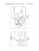 Container for Dispensing a Pasty Filling Compound for Use with a Hand-held     Device and Hand-held Device diagram and image