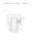 DENTAL IMPLANT diagram and image