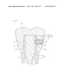 DENTAL IMPLANT diagram and image