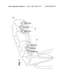 DENTAL IMPLANT diagram and image