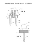 DENTAL IMPLANT diagram and image