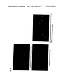 METHOD AND KIT FOR DETECTION OF MICROORGANISM diagram and image