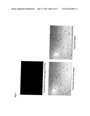 METHOD AND KIT FOR DETECTION OF MICROORGANISM diagram and image