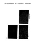 METHOD AND KIT FOR DETECTION OF MICROORGANISM diagram and image