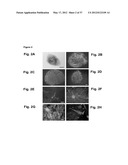 NEURAL PROGENITOR CELLS DERIVED FROM EMBRYONIC STEM CELLS diagram and image