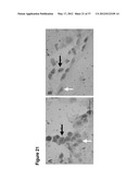 NEURAL PROGENITOR CELLS DERIVED FROM EMBRYONIC STEM CELLS diagram and image