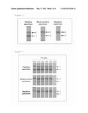 ALLOYED METAL COLLOID diagram and image