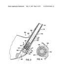 GOLF CLUB HEAD diagram and image