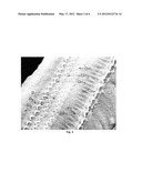 CELL LINE DERIVED FROM THE EPITHELIAL LINING OF THE HUMAN ENDOLYMPHATIC     SAC IN THE INNER EAR diagram and image