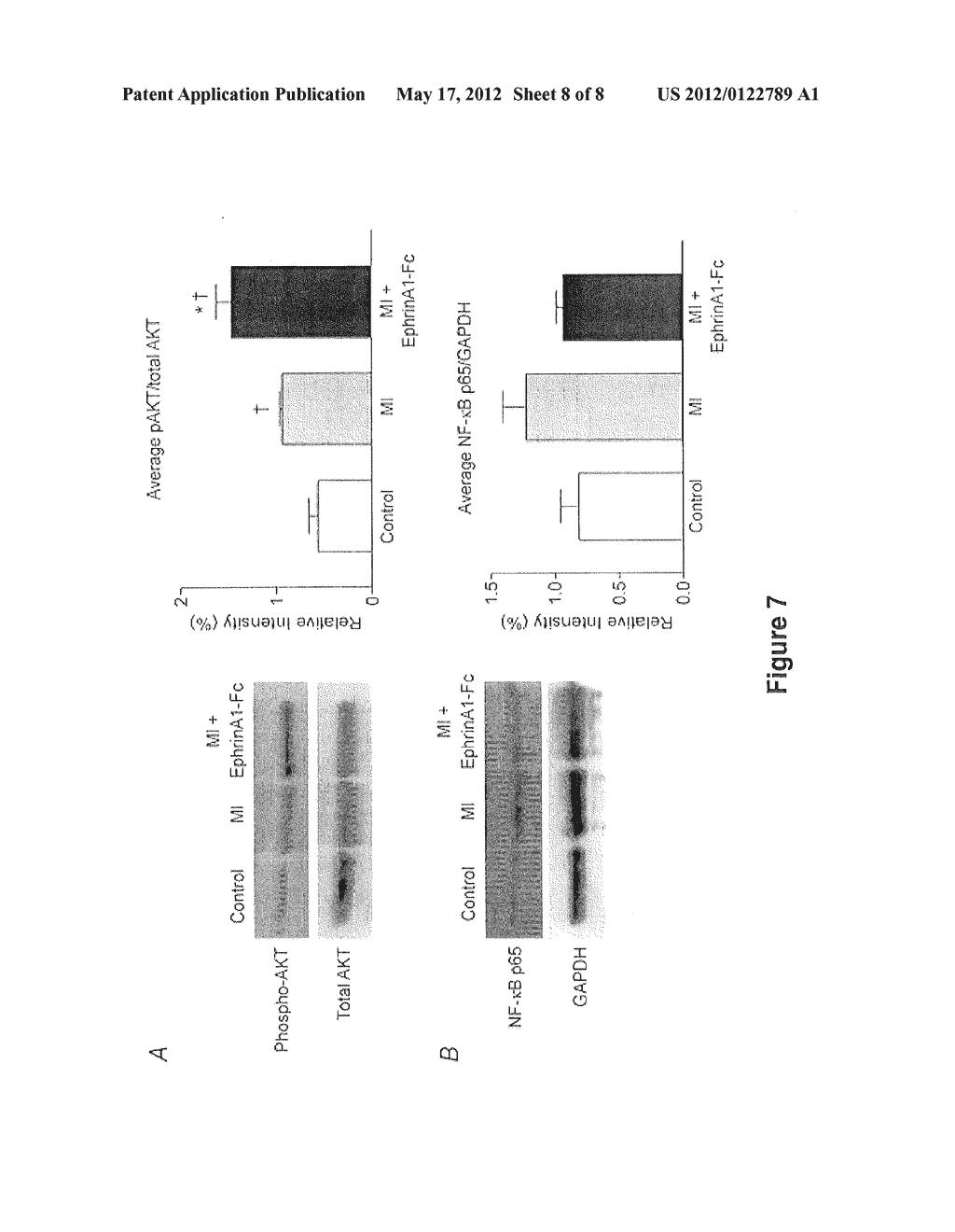 Methods of Reducing Myocardial Injury Following Myocardial Infarction - diagram, schematic, and image 09