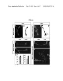 ACCELERATED EXTENSION OF AXONS diagram and image
