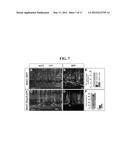 ACCELERATED EXTENSION OF AXONS diagram and image