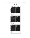 ACCELERATED EXTENSION OF AXONS diagram and image