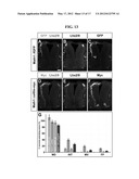 ACCELERATED EXTENSION OF AXONS diagram and image