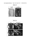 ACCELERATED EXTENSION OF AXONS diagram and image