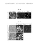 ACCELERATED EXTENSION OF AXONS diagram and image