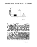 Treatment Of Ischemia-Reperfusion Injury diagram and image