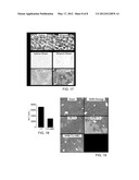 Treatment Of Ischemia-Reperfusion Injury diagram and image