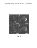 SMALL MOLECULE INHIBITORS OF Dusp6 AND USES THEREFOR diagram and image