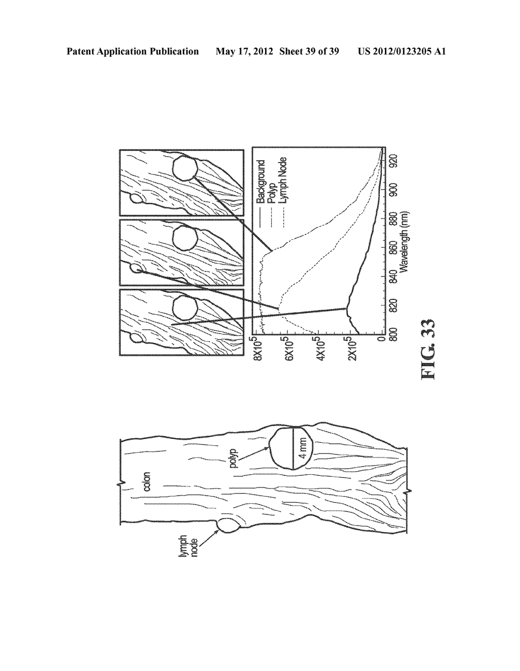 ADDITIONAL SYSTEMS AND METHODS FOR PROVIDING REAL-TIME ANATOMICAL GUIDANCE     IN A DISGNOSTIC OR THERAPEUTIC PROCEDURE - diagram, schematic, and image 40