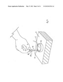 WOUND RETRACTOR diagram and image