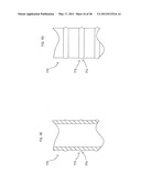 CANNULA SYSTEM diagram and image