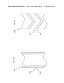 CANNULA SYSTEM diagram and image