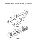 STABILIZER FOR ROBOTIC BEATING-HEART SURGERY diagram and image