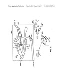 STABILIZER FOR ROBOTIC BEATING-HEART SURGERY diagram and image