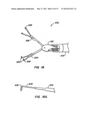 STABILIZER FOR ROBOTIC BEATING-HEART SURGERY diagram and image