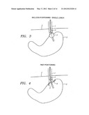 METHODS AND APPARATUS FOR TESTING DISRUPTION OF A VAGAL NERVE diagram and image