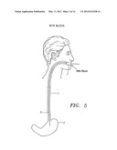 METHODS AND APPARATUS FOR TESTING DISRUPTION OF A VAGAL NERVE diagram and image