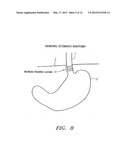 METHODS AND APPARATUS FOR TESTING DISRUPTION OF A VAGAL NERVE diagram and image