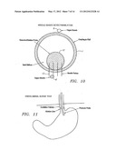 METHODS AND APPARATUS FOR TESTING DISRUPTION OF A VAGAL NERVE diagram and image