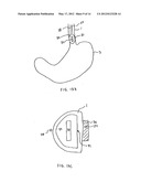 METHODS AND APPARATUS FOR TESTING DISRUPTION OF A VAGAL NERVE diagram and image