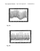 METHOD AND APPARATUS FOR DETERMINING HEART RATE VARIABILITY USING WAVELET     TRANSFORMATION diagram and image