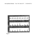 METHOD AND APPARATUS FOR DETERMINING HEART RATE VARIABILITY USING WAVELET     TRANSFORMATION diagram and image