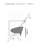 TISSUE-CHARACTERIZATION PROBE WITH EFFECTIVE SENSOR-TO-TISSUE CONTACT diagram and image