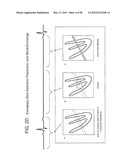 DARK BLOOD DELAYED ENHANCEMENT MAGNETIC RESONANCE VIABILITY IMAGING     TECHNIQUES FOR ASSESSING SUBENDOCARDIAL INFARCTS diagram and image