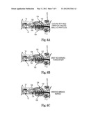 Renal Nerve Ablation Using Mild Freezing and Vibration diagram and image