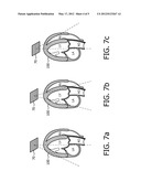 THREE DIMENSIONAL FETAL HEART IMAGING BY NON-ECG PHYSIOLOGICAL GATED     ACQUISITION diagram and image