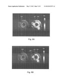 SYSTEMS AND METHODS FOR MAKING AND USING ROTATIONAL TRANSDUCERS FOR     CONCURRENTLY IMAGING BLOOD FLOW AND TISSUE diagram and image