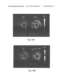 SYSTEMS AND METHODS FOR MAKING AND USING ROTATIONAL TRANSDUCERS FOR     CONCURRENTLY IMAGING BLOOD FLOW AND TISSUE diagram and image