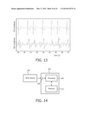METHOD AND APPARATUS FOR THE ANALYSIS OF A  BALLISTOCARDIOGRAM SIGNAL diagram and image