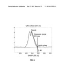 Apparatus, Method, And Computer Program For Predicting Risk For Cardiac     Death diagram and image