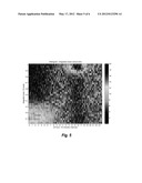 EEG MONITORING SYSTEM AND METHOD OF MONITORING AN EEG diagram and image