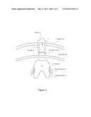 Nerve Mapping Surgical System and Method of Use of Dual Function Surgical     Instrument Within Such System diagram and image