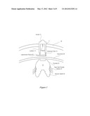 Nerve Mapping Surgical System and Method of Use of Dual Function Surgical     Instrument Within Such System diagram and image