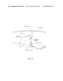 Nerve Mapping Surgical System and Method of Use of Dual Function Surgical     Instrument Within Such System diagram and image