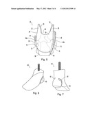 Orthotic device and method of manufacture diagram and image